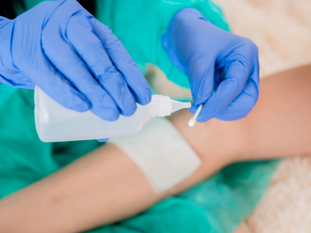 Chlorhexidine Wipes