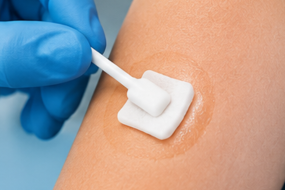 CHG Swabs1