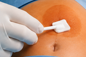 CHG Swabs2