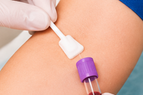 CHG Swabs4